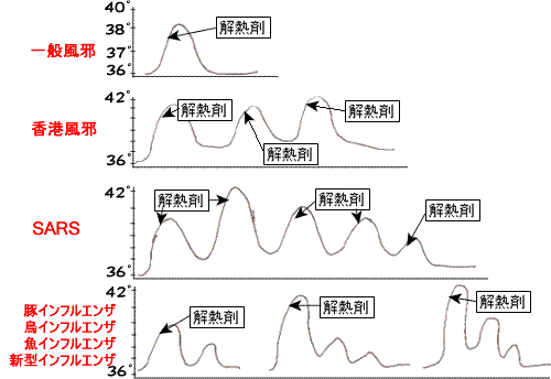 インフルエンザ毎の発熱パターン